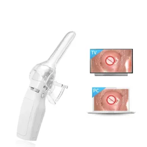 FA2 Digital Video Electronic Mini Colposcope Hospitals Cervix Vagina Examine Machine Women Gynecological Diseases Self-exam