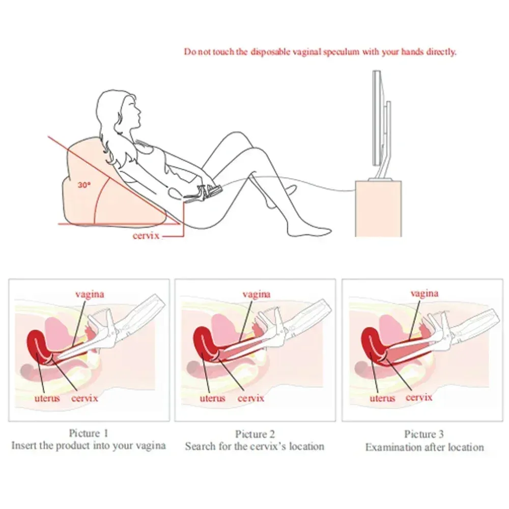 Mini Colposcope with Digital Video for Accurate and Convenient Health Monitoring Optional Monitors Self-testing Accessories